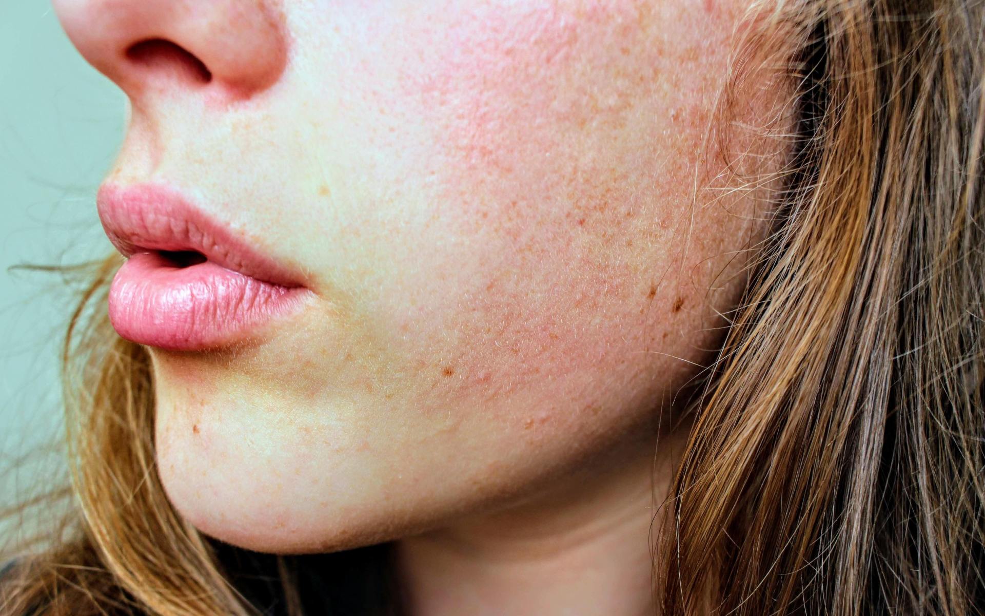 12 Skin Sins You Should Never Commit