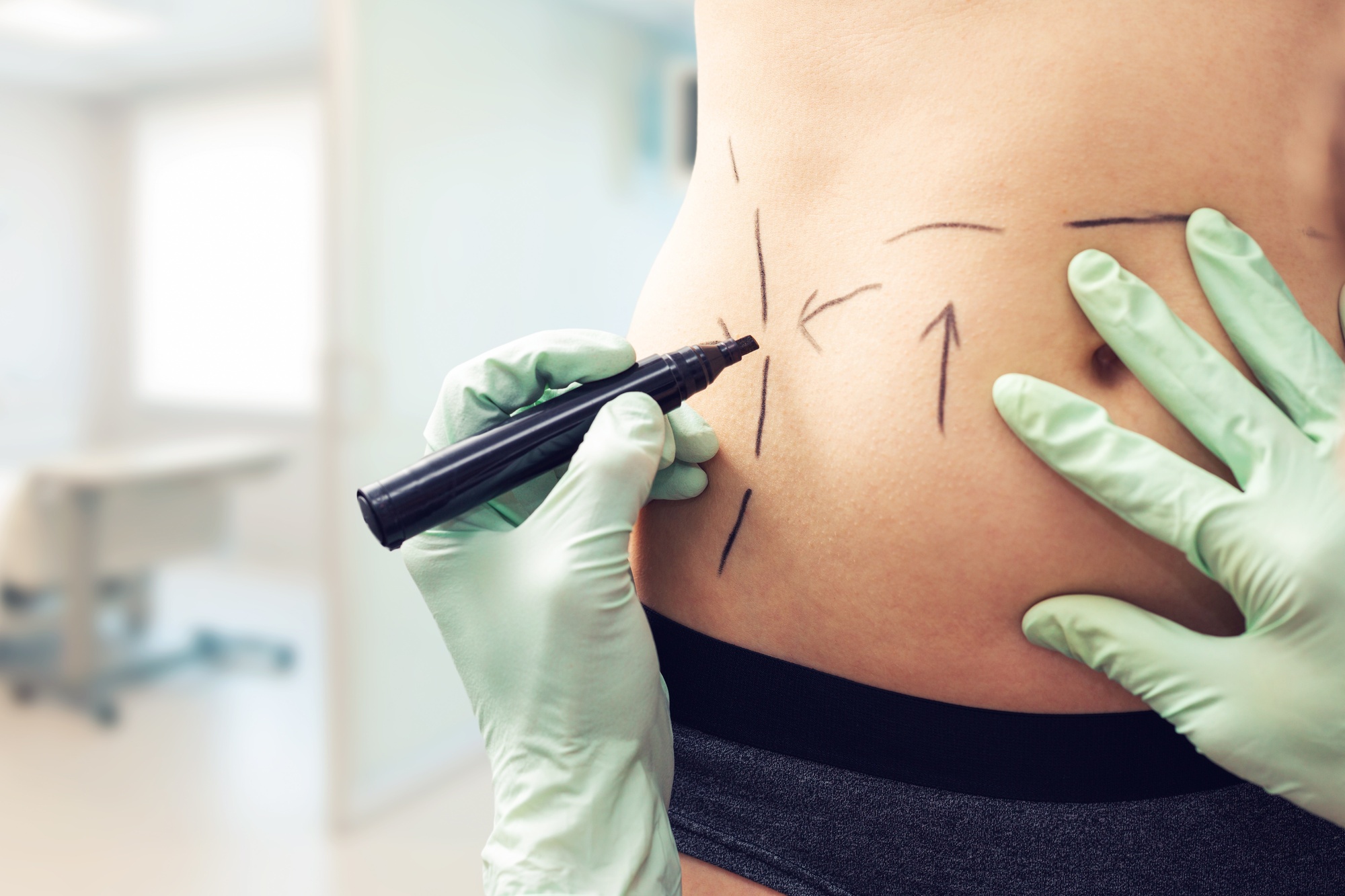 Top Cosmetic Surgeries: 5 of the Most Popular Procedures