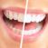Does Salt For Teeth Whitening Work & Which Other Methods Can You Try?