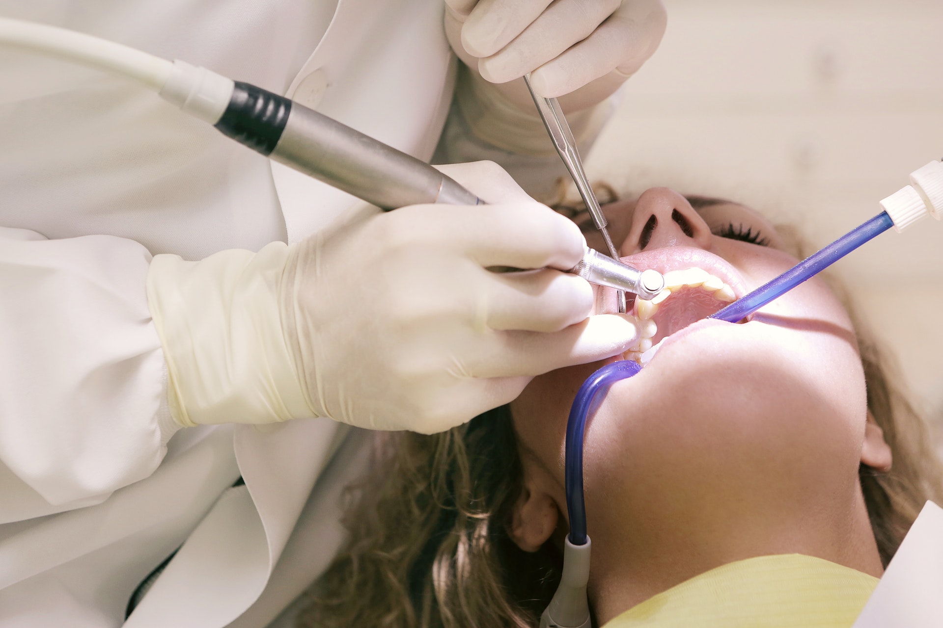 Critical Tips to Prepare for a Root CanalCritical Tips to Prepare for a Root Canal
