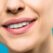 Dental Veneers for Repairing Imperfections on Your Teeth