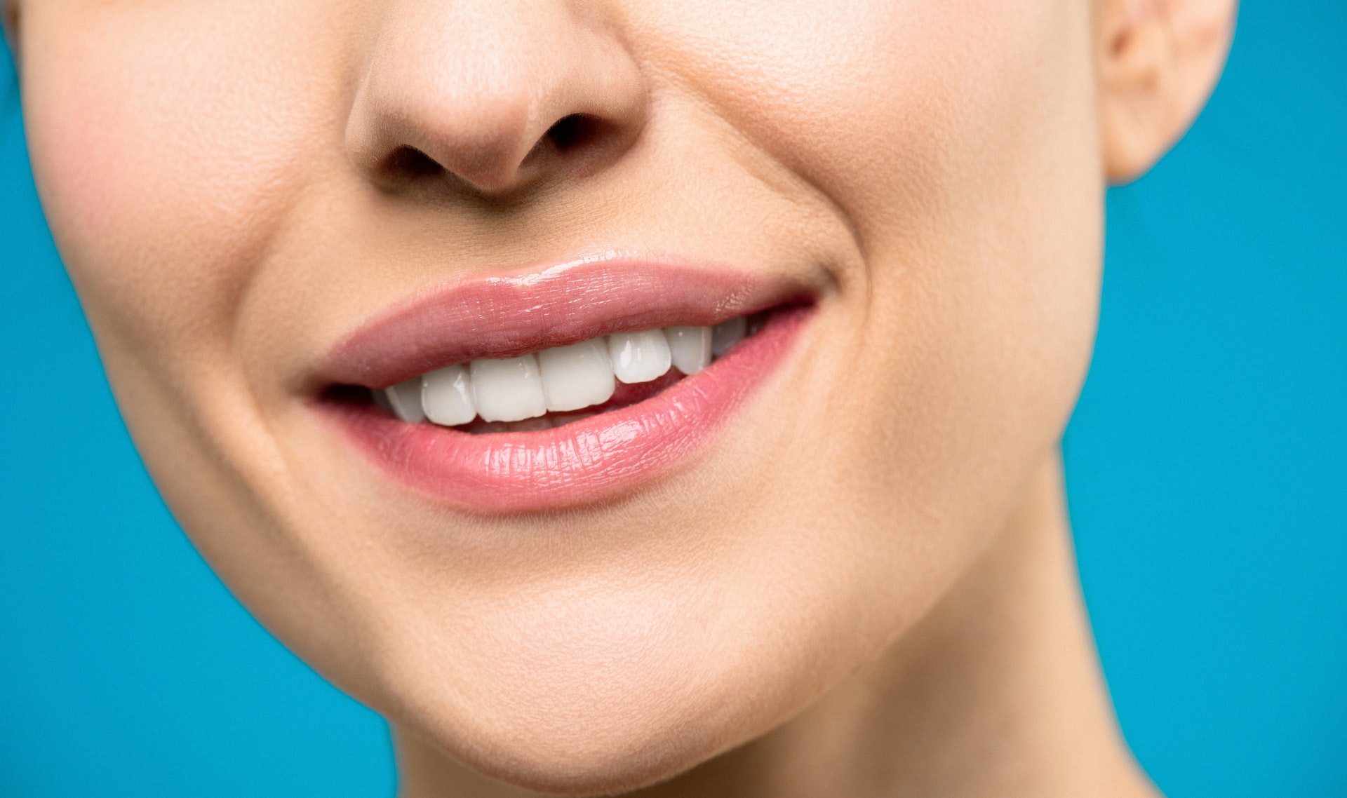 Dental Veneers for Repairing Imperfections on Your Teeth