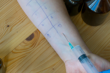 The Importance and What to Expect During a Skin Prick Test