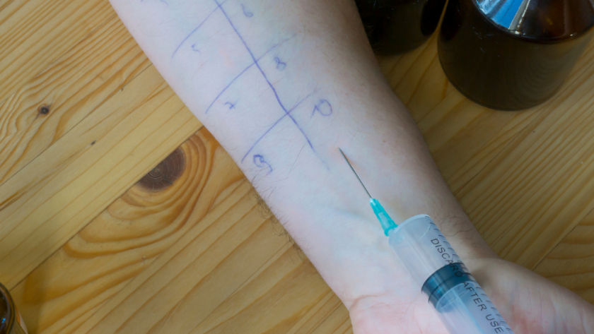 The Importance and What to Expect During a Skin Prick Test