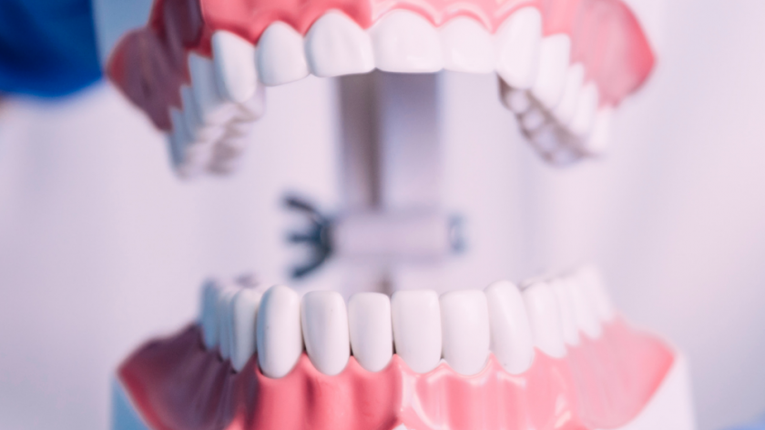 Are You Considering Dental Implants? Learn About Their Benefits