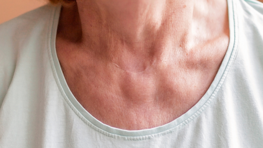 What You May Not Know About Thyroid Surgery