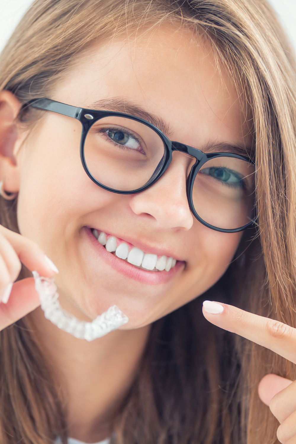 Thinking of Invisalign? Here Are the Benefits You Should Know