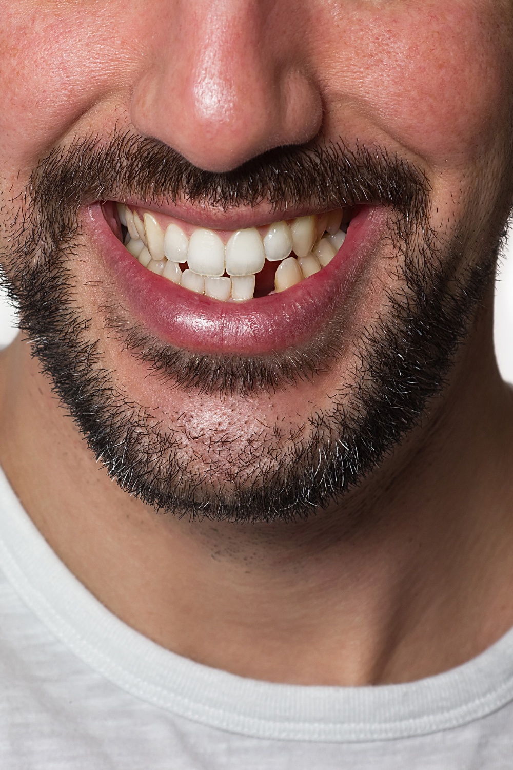 Understanding The Options When You Have Missing Teeth