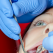 What You Need To Know About Root Canals