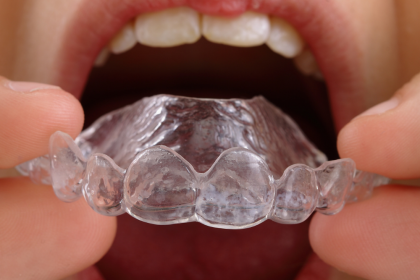 Here are 5 Fantastic Facts About Retainers