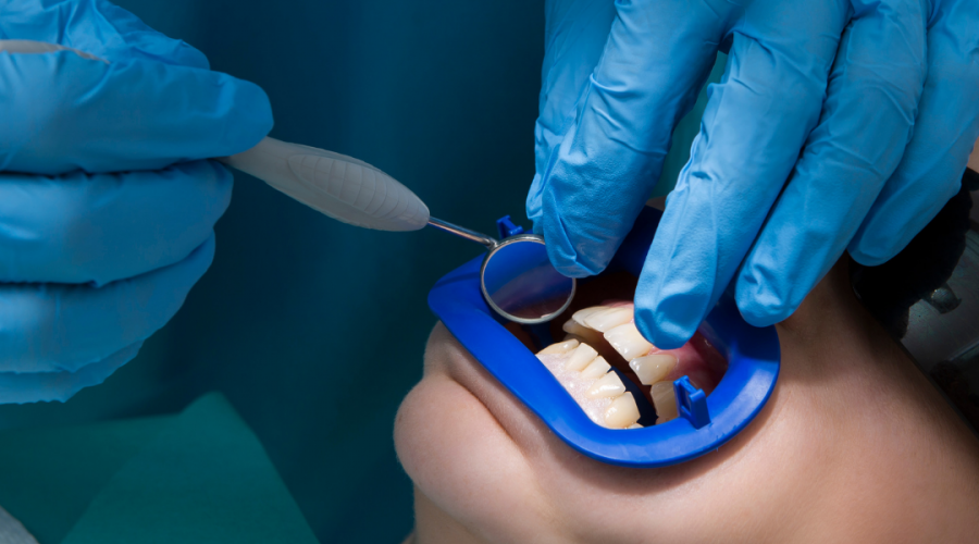 A Guide to Selecting a Restorative Dentist in New York