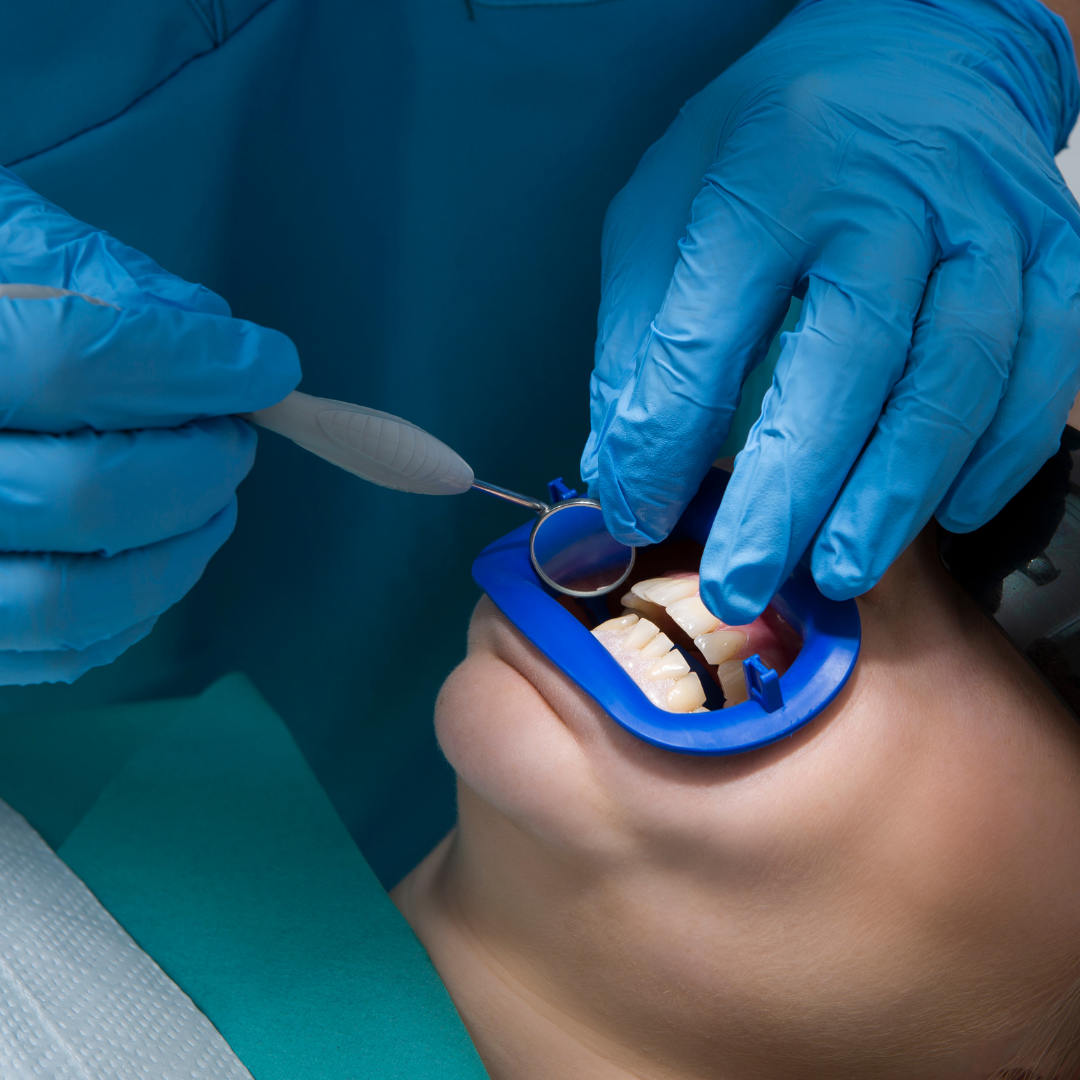 A Guide to Selecting a Restorative Dentist in New York