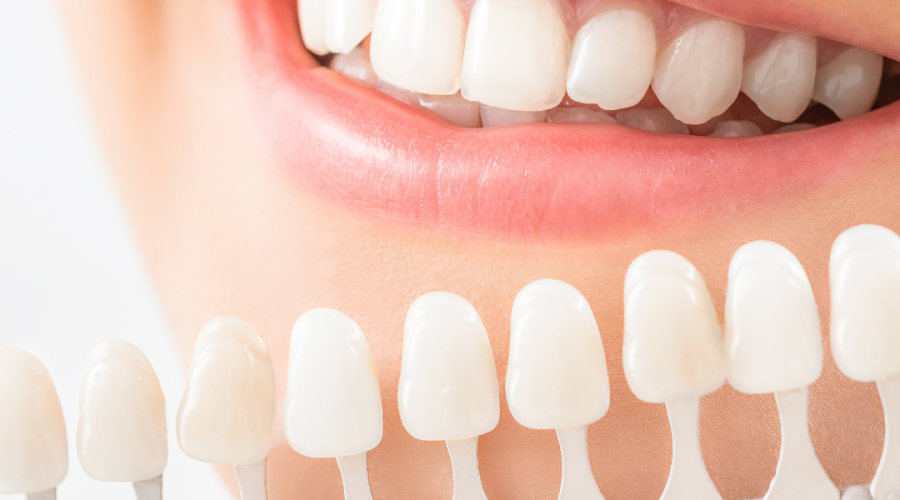 How Do Dental Crowns and Bridges Work?
