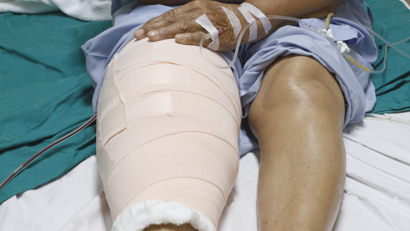 How to Speed up Recovery After A Knee Replacement - Understanding the Facts