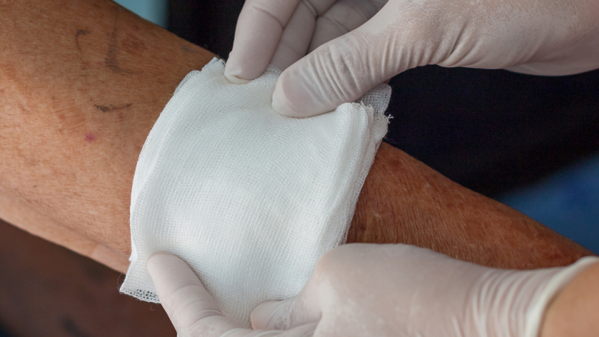 Common Questions About Wound Care
