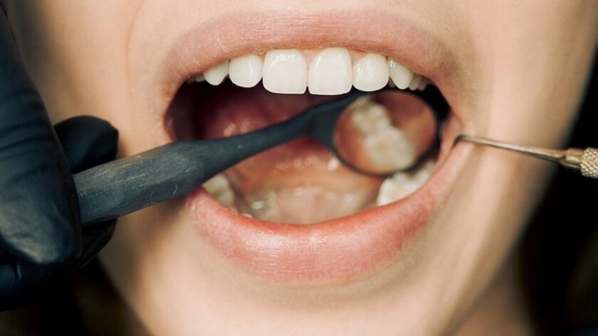 10 Foods to Avoid for Healthier Teeth and Gums