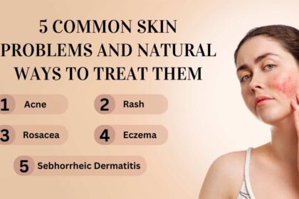 5 Common Skin Problems and Natural Ways to Treat Them