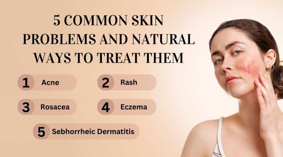 5 Common Skin Problems and Natural Ways to Treat Them