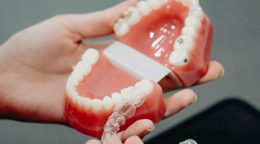 The Ultimate Guide to Straightening Your Teeth with Invisalign